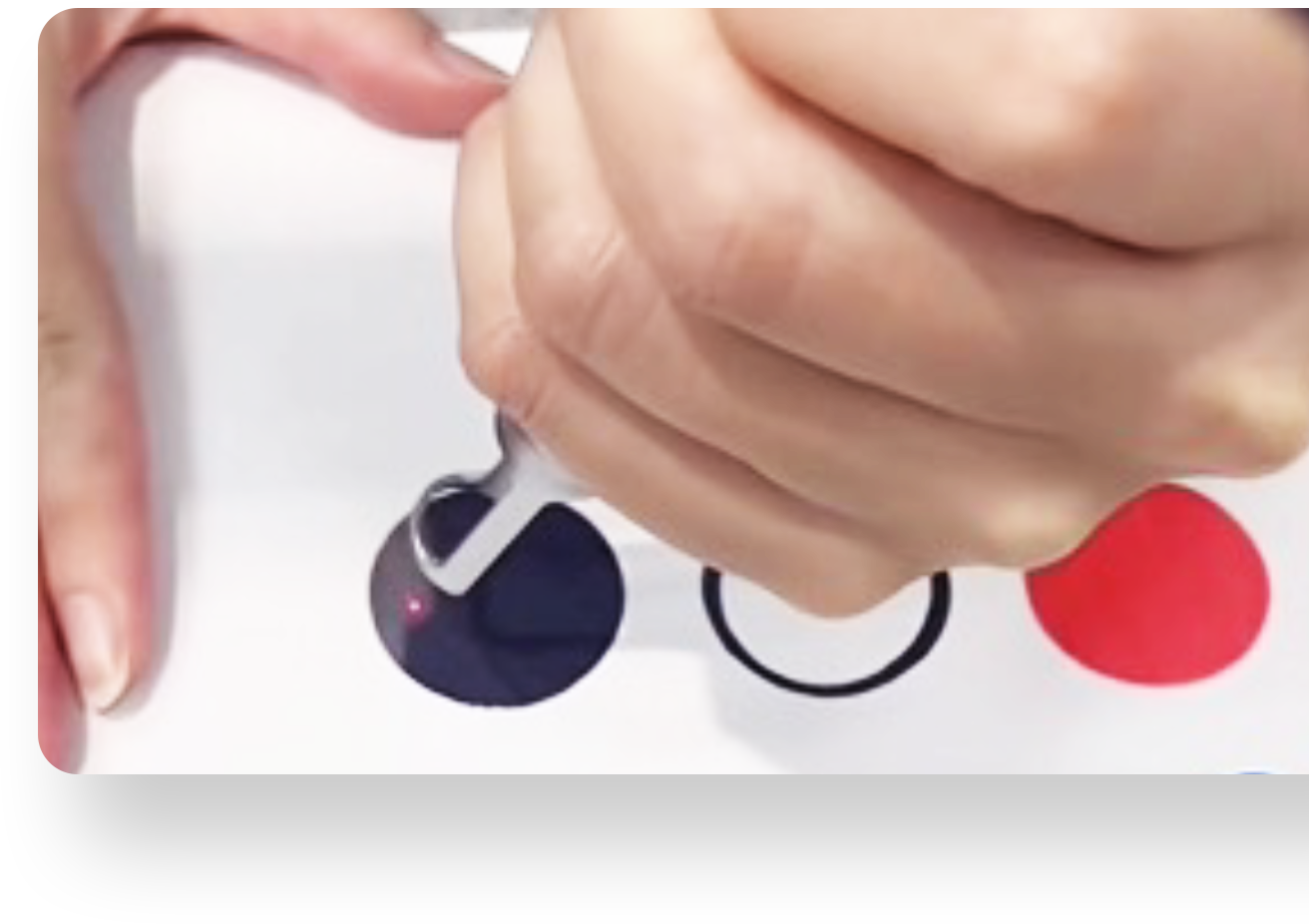 シミ取りレーザー治療&シミ取り放題 | 美容皮膚科・銀座美容外科クリニック